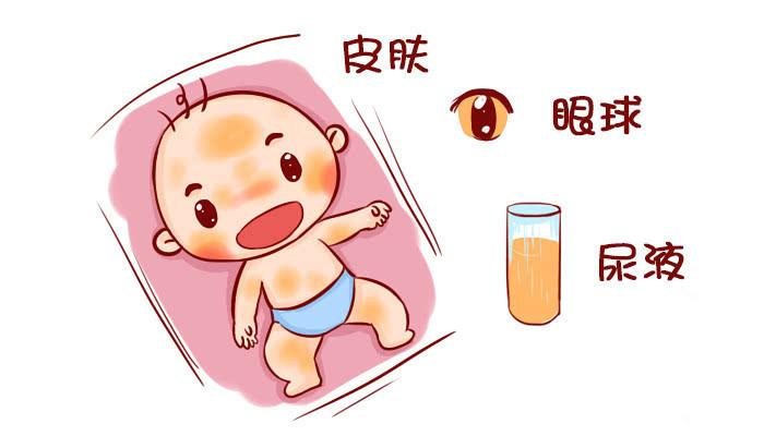 新生兒出生沒黃疸，大多是孕媽在孕期做了3件事